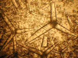 Vue microscopique de spicules à trois branches.